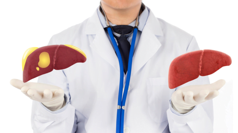 Weight Loss for Fatty Liver