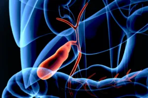 Learn to find out if the use of GLP-1 cause gallstones